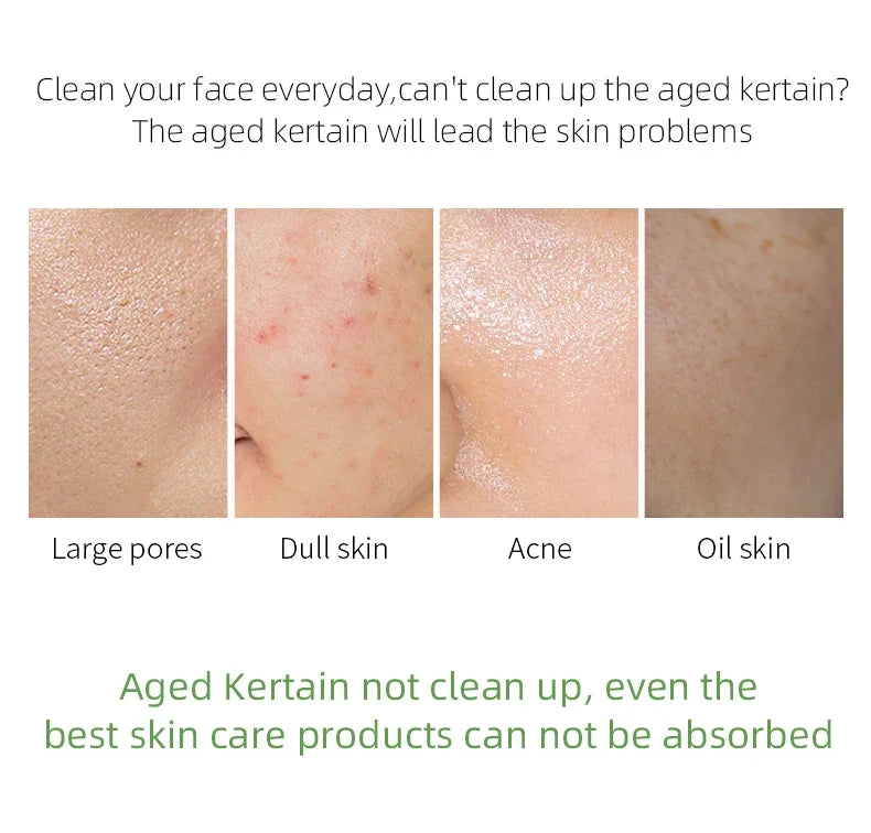 Skin Care
