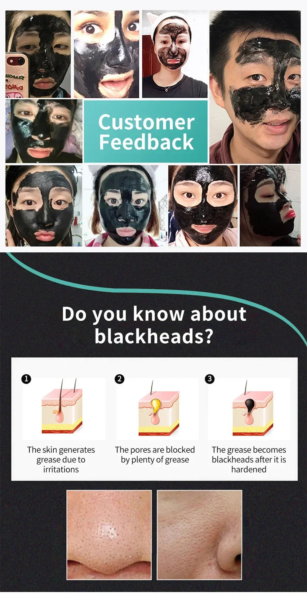 LANBENA Blackhead Removal & Pore Treatment Mask (Copy)...................