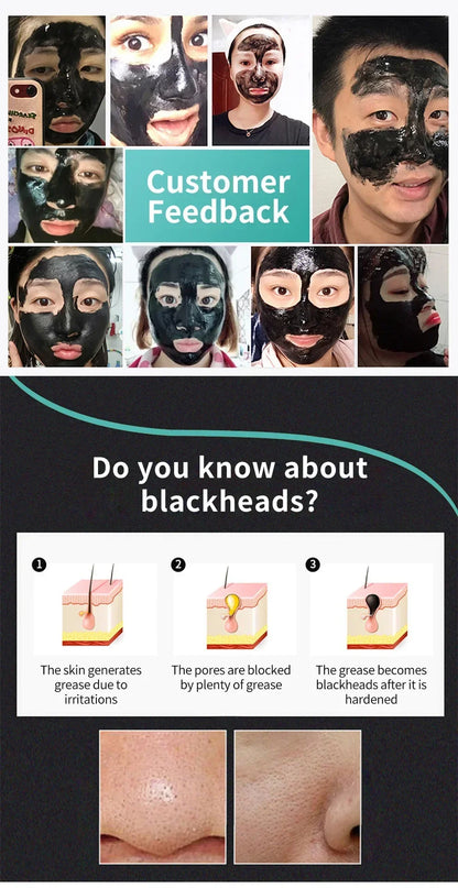 LANBENA Blackhead Removal & Pore Treatment Mask (Copy)...................