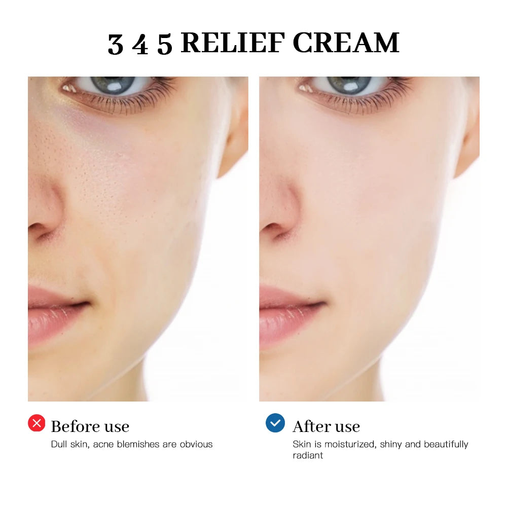 345 Relief Cream - Complete Skin Solution