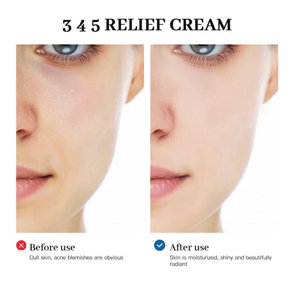 345 Relief Cream - Complete Skin Solution